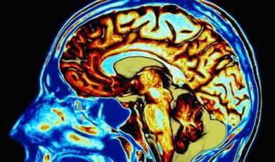 Brain X-ray