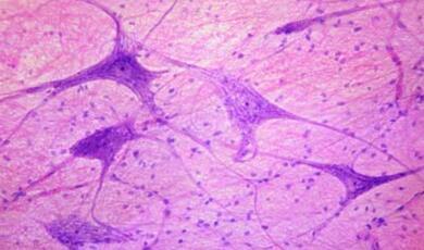 neurons in tissue