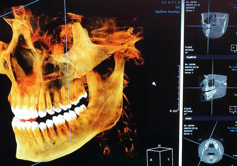 an x-ray image of a human jaw