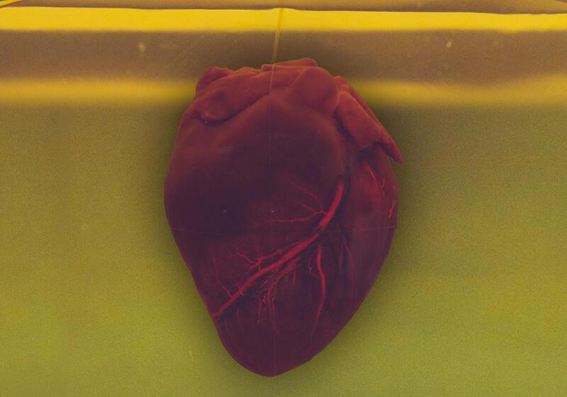 a picture of a human heart in yellow liquid