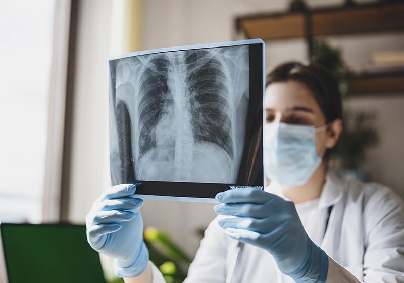 a woman examining an x-ray of a chest