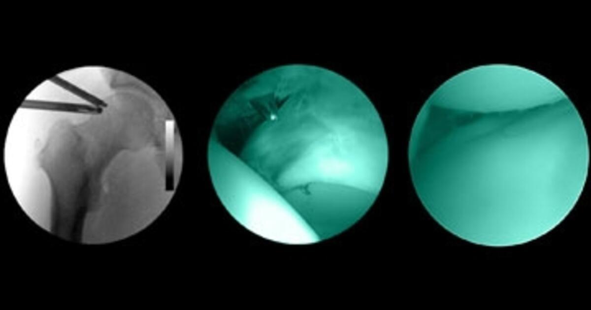 Keyhole Surgery Pioneers