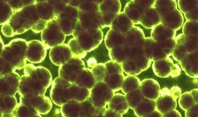 population of bacteria close up