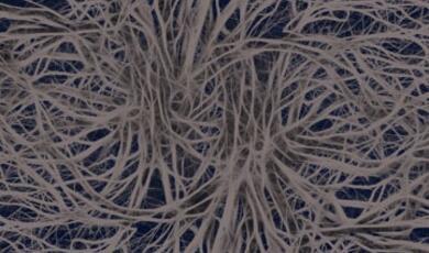 Close-up of human nerves under microscope