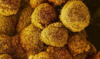 Image of cancer cells
