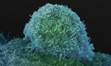 Image of prostate cancer cell