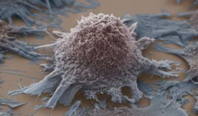Image of lung cancer cell