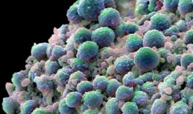 Image of cancer cells