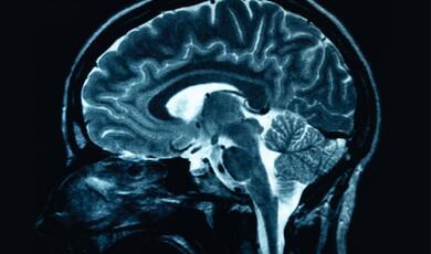 scan of a brain