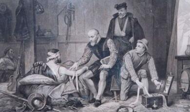 ambroise pare treating wounded soldiers