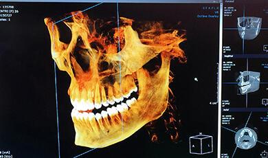 an x-ray image of a human jaw