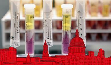 test tubes with London skyline in foreground